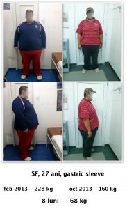 scapa de obezitate, interventii obezitate, consultatie online obezitate, micsorare stomac, inel gastric, pret micsorare stomac,