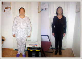 scapa de obezitate, interventii obezitate, consultatie online obezitate, micsorare stomac, inel gastric, pret micsorare stomac,