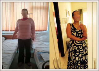 scapa de obezitate, interventii obezitate, consultatie online obezitate, micsorare stomac, inel gastric, pret micsorare stomac,