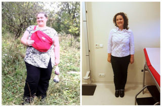 scapa de obezitate, interventii obezitate, consultatie online obezitate, micsorare stomac, inel gastric, pret micsorare stomac,