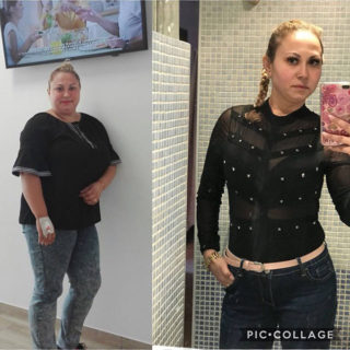 scapa de obezitate, interventii obezitate, consultatie online obezitate, micsorare stomac, inel gastric, pret micsorare stomac,