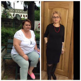 scapa de obezitate, interventii obezitate, consultatie online obezitate, micsorare stomac, inel gastric, pret micsorare stomac,