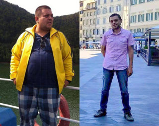 scapa de obezitate, interventii obezitate, consultatie online obezitate, micsorare stomac, inel gastric, pret micsorare stomac,