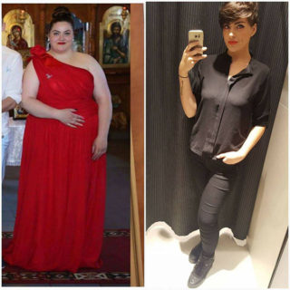 scapa de obezitate, interventii obezitate, consultatie online obezitate, micsorare stomac, inel gastric, pret micsorare stomac,