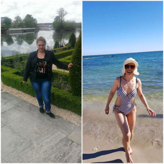 scapa de obezitate, interventii obezitate, consultatie online obezitate, micsorare stomac, inel gastric, pret micsorare stomac,
