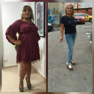 scapa de obezitate, interventii obezitate, consultatie online obezitate, micsorare stomac, inel gastric, pret micsorare stomac,