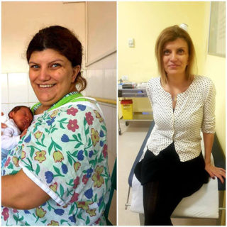 scapa de obezitate, interventii obezitate, consultatie online obezitate, micsorare stomac, inel gastric, pret micsorare stomac,