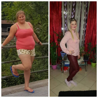 scapa de obezitate, interventii obezitate, consultatie online obezitate, micsorare stomac, inel gastric, pret micsorare stomac,